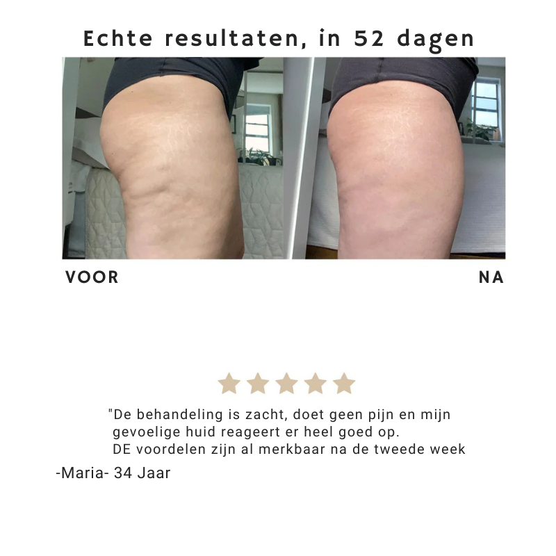 Mira™ | Anti cellulite - Je huid, maar dan strakker