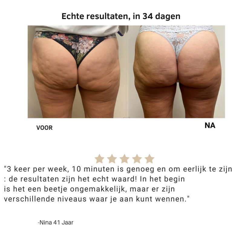 Mira™ | Anti cellulite - Je huid, maar dan strakker