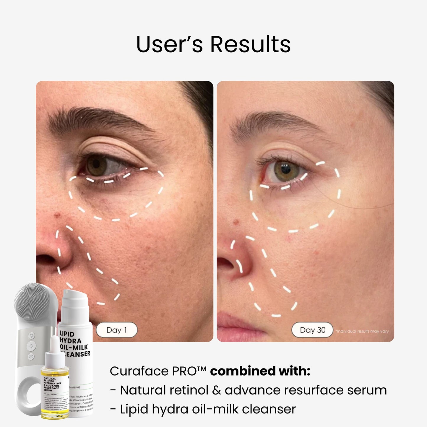 Glow Ritual pro™|Jouw stralende huid, stap voor stap