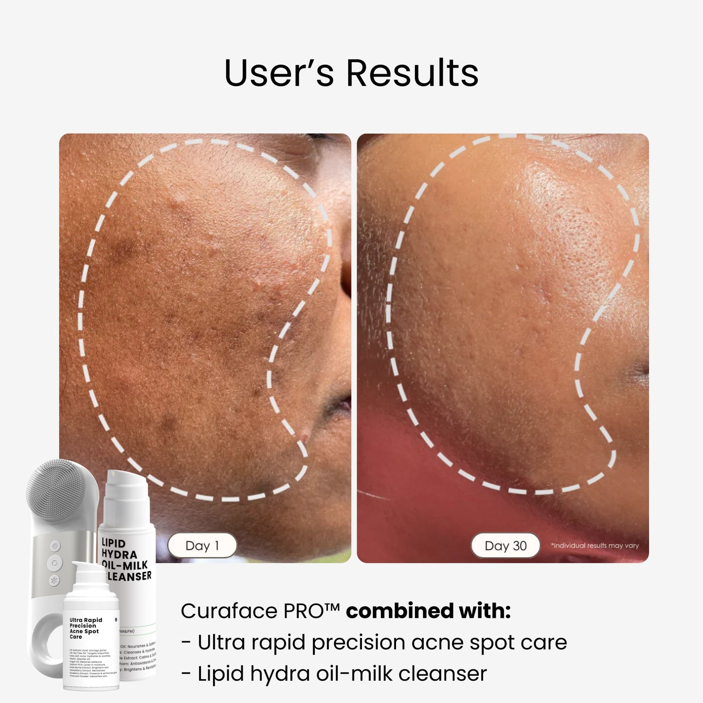 Glow Ritual pro™|Jouw stralende huid, stap voor stap
