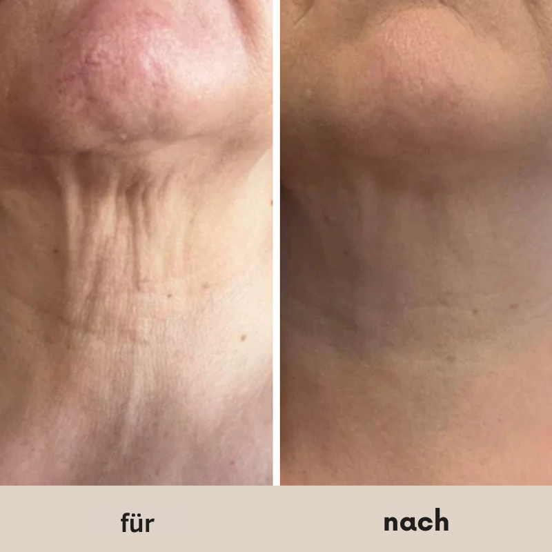 Firming - Straffende Creme für den Hals