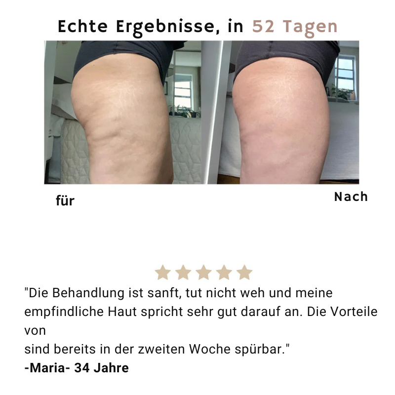 Mira™ – Anti-Cellulite Massagegerät