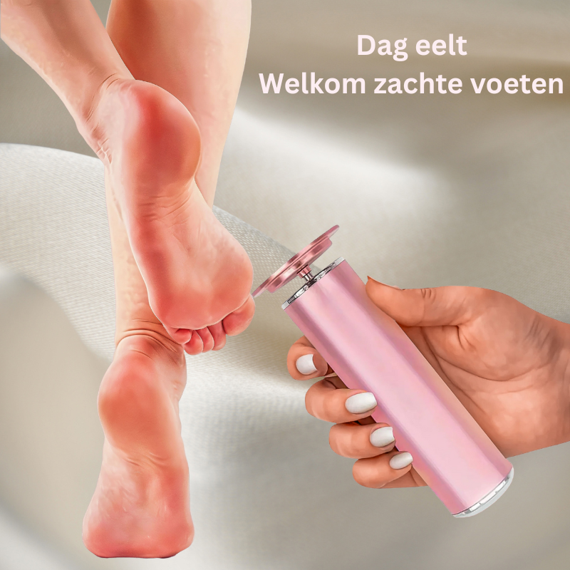 SmoothStep™ |Elektrische Eeltverwijderaar