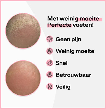 SmoothstapPads™ 60 stuks